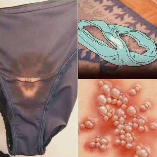 Read more about the article BE CAREFUL, if you notice this in your underwear, it means you have Ca
