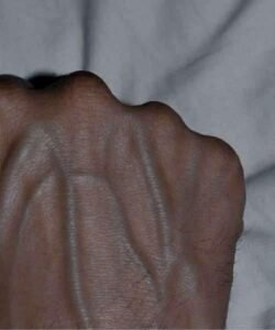 Read more about the article If your veins are visible in your hand, it is a signal of ca…
