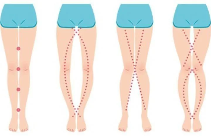 Read more about the article A WOMAN’S LEGS CAN TELL HOW HER IS