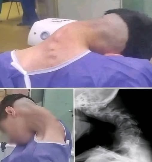 Read more about the article Young man hospitalized because he dropped his ca… See more