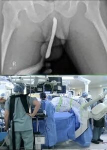 Read more about the article Girl had to be hospitalized for wanting to use a pe…See more
