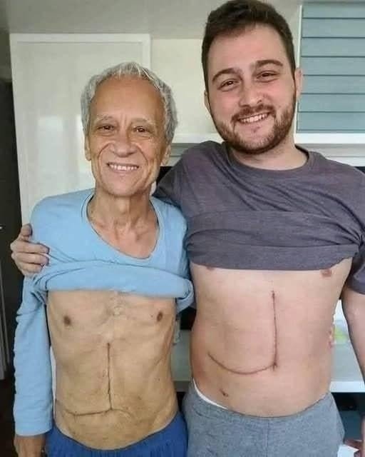 Read more about the article Son who donated part of his liver to his father unfortunately ends up fa…