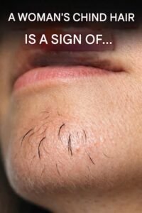 Read more about the article A woman’s chin hair is a sign of…See more