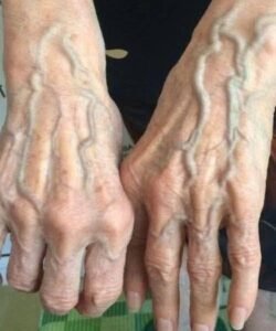 Read more about the article If your veins are visible, it means you are… See more