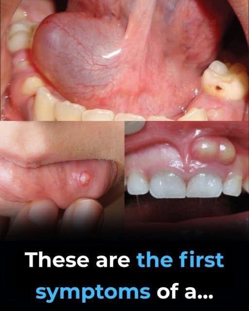 Read more about the article Hidden Dangers in Your Mouth