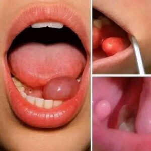 Read more about the article These are the first symptoms of a… See more