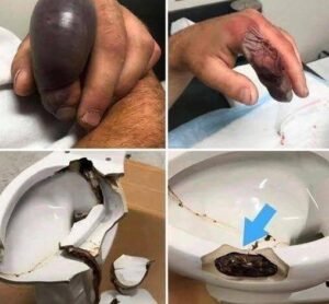 Read more about the article He went to the bathroom without knowing that there was a…See more