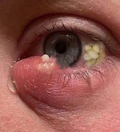 Read more about the article ;These are the consequences of sleeping with a… See more