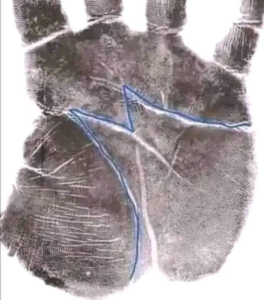 Read more about the article What Does the “M” on Your Palm Say About Love?