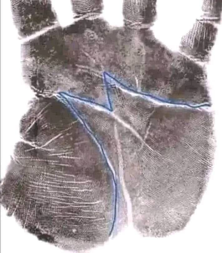Read more about the article What Does the “M” on Your Palm Say About Love?
