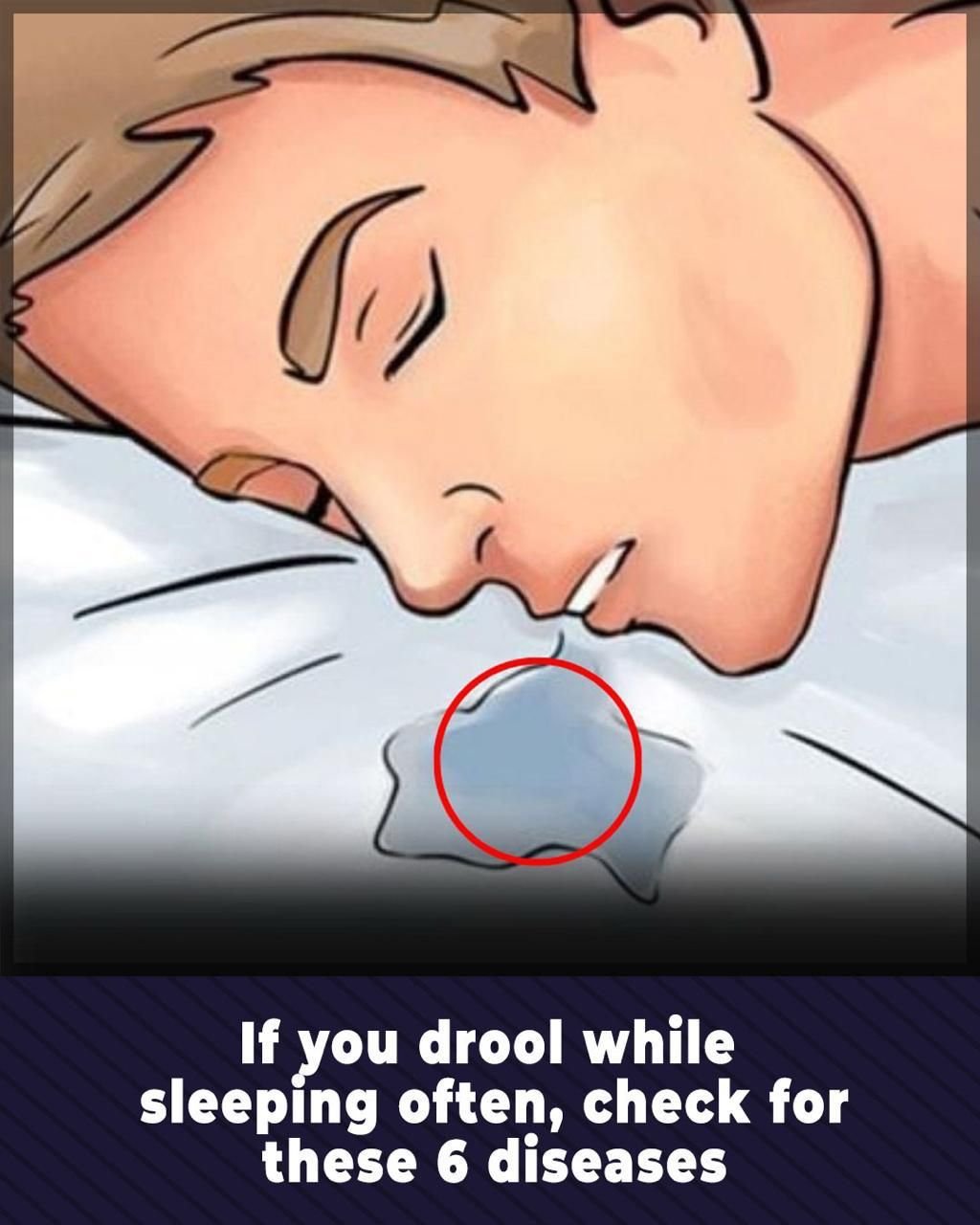 Read more about the article 8 Conditions Linked to Drooling While Sleeping You Should Get Checked