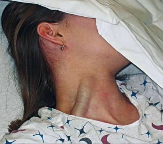 Read more about the article She Woke Up With Marks She Couldn’t Explain