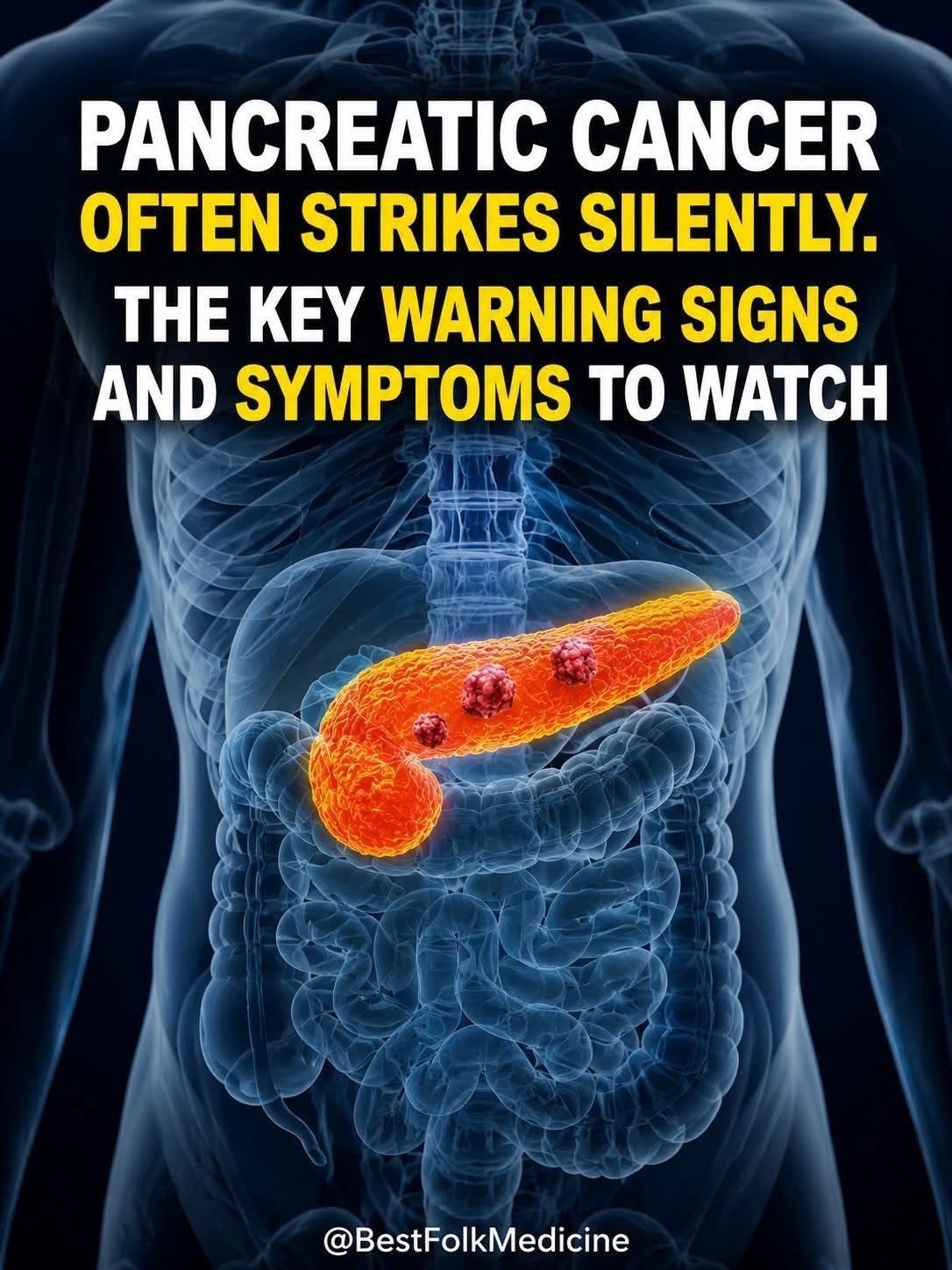 Read more about the article Signs of pancreatic cancer you should never ignore