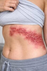 Read more about the article These are the consequences of sleeping with your c… See more