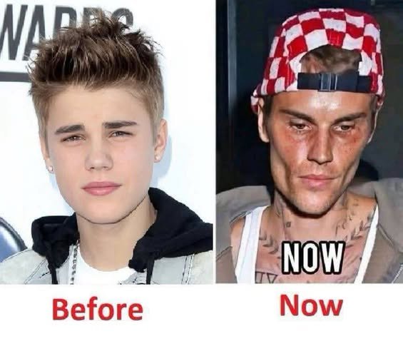 Read more about the article Justin Bieber admits that he tested positive for…See more