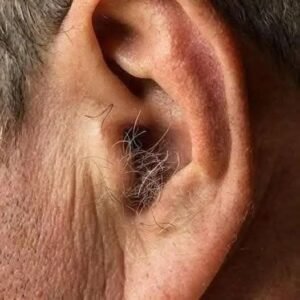 Read more about the article Did You Know That If Hair Grows On Your Ears It Is Not A Sign Of Illness Or Mystery But A Natural Result Of Aging Hormones Genetics And Time Working Quietly Inside The Human Body Over Many Decades