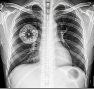Read more about the article Warning: People vaccinated against COVID-19 may… See more