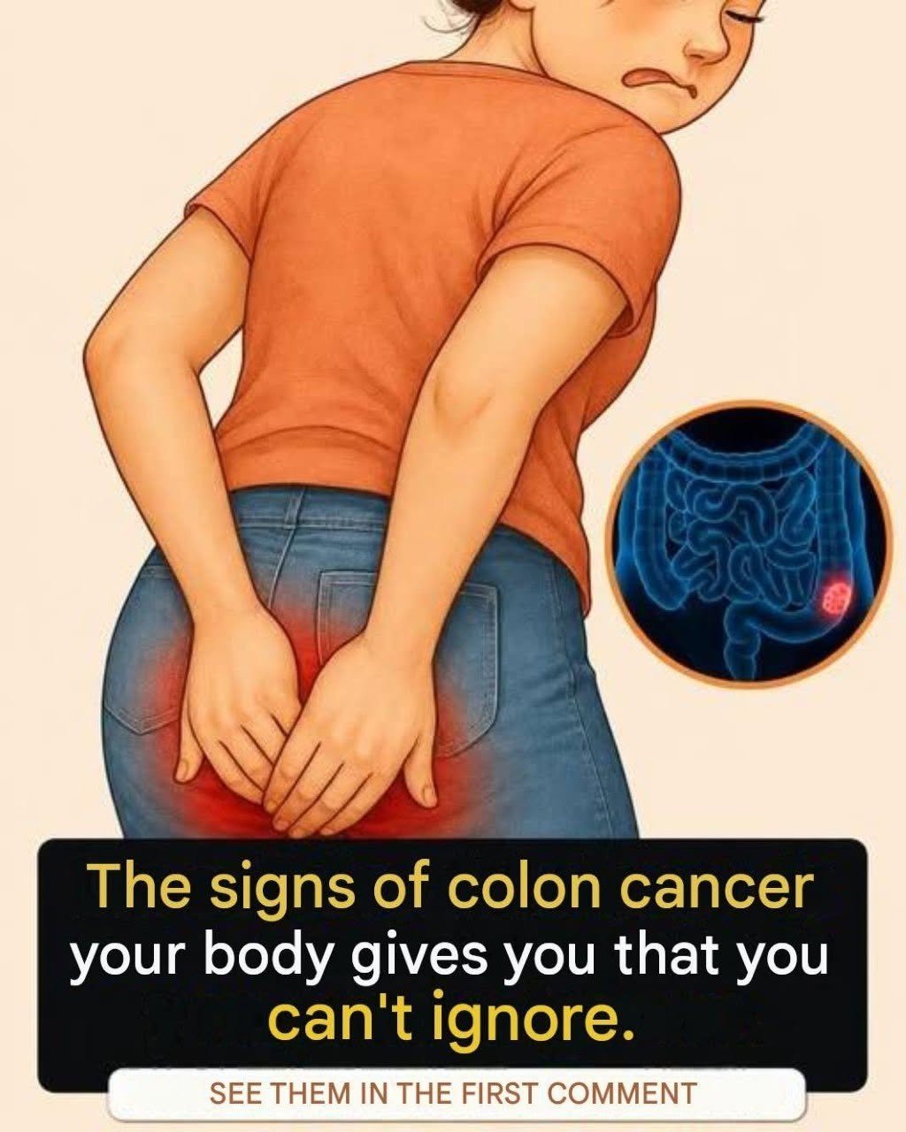 Read more about the article You may have colon cancer if you…See More