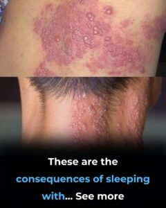 Read more about the article These are the consequences of sleeping with the…