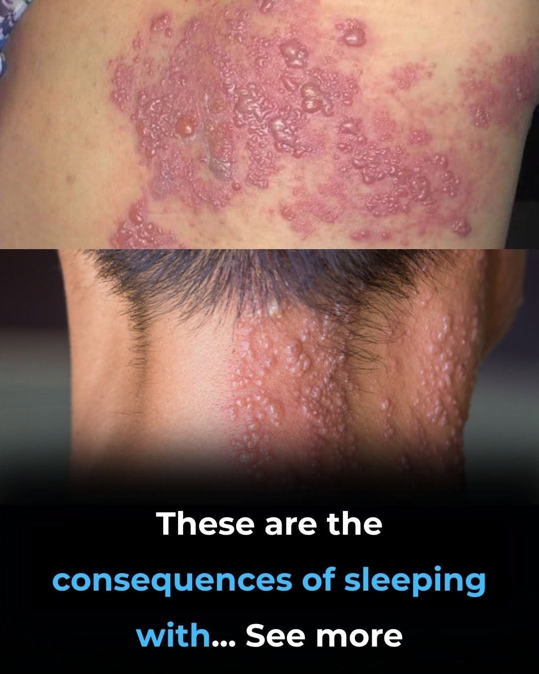 Read more about the article These are the consequences of sleeping with the…