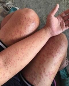Read more about the article I Stayed at My Friend’s Old Apartment for a Few Days Then I Noticed These Strange Bumps
